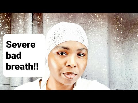 ⁣THEY WILL ROT FROM INSIDE OUT! DIRTY CEASERS BLAM!NG  OH MIKE RUN- O.MIC.RON!! *MUST WATCH  SHARE*