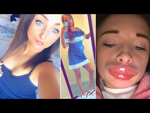 When Cosmetic Surgery Goes Horribly Wrong